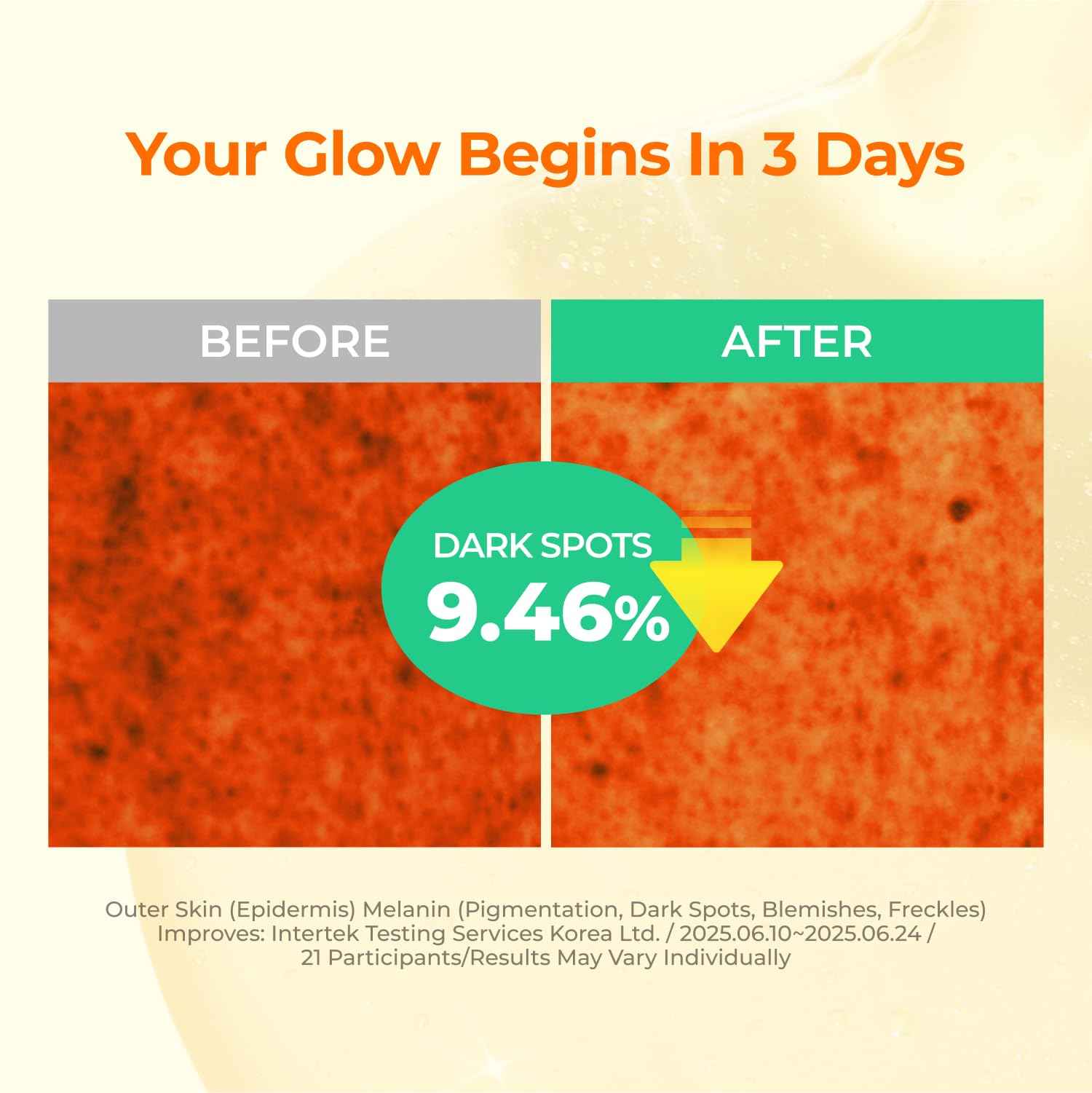 SINSURU 15% Niacinamide + Alpha Albutin + Banana PDRN Starry Niacin 15 Correcting Serum – Potent Brightening Serum for Uneven Tone & Dark Spots, Fragrance-Free | Korean Skincare (1.01 fl.oz / 30ml)