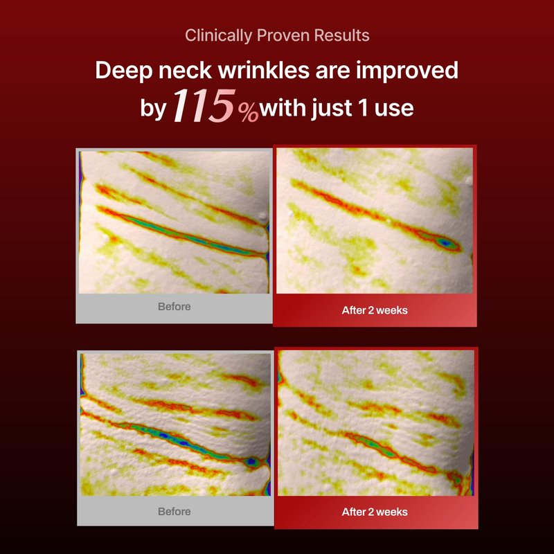 Neck Wrinkle Patches - Firming Korean Collagen Masks for Lifting Sagging Skin | 7 Pack