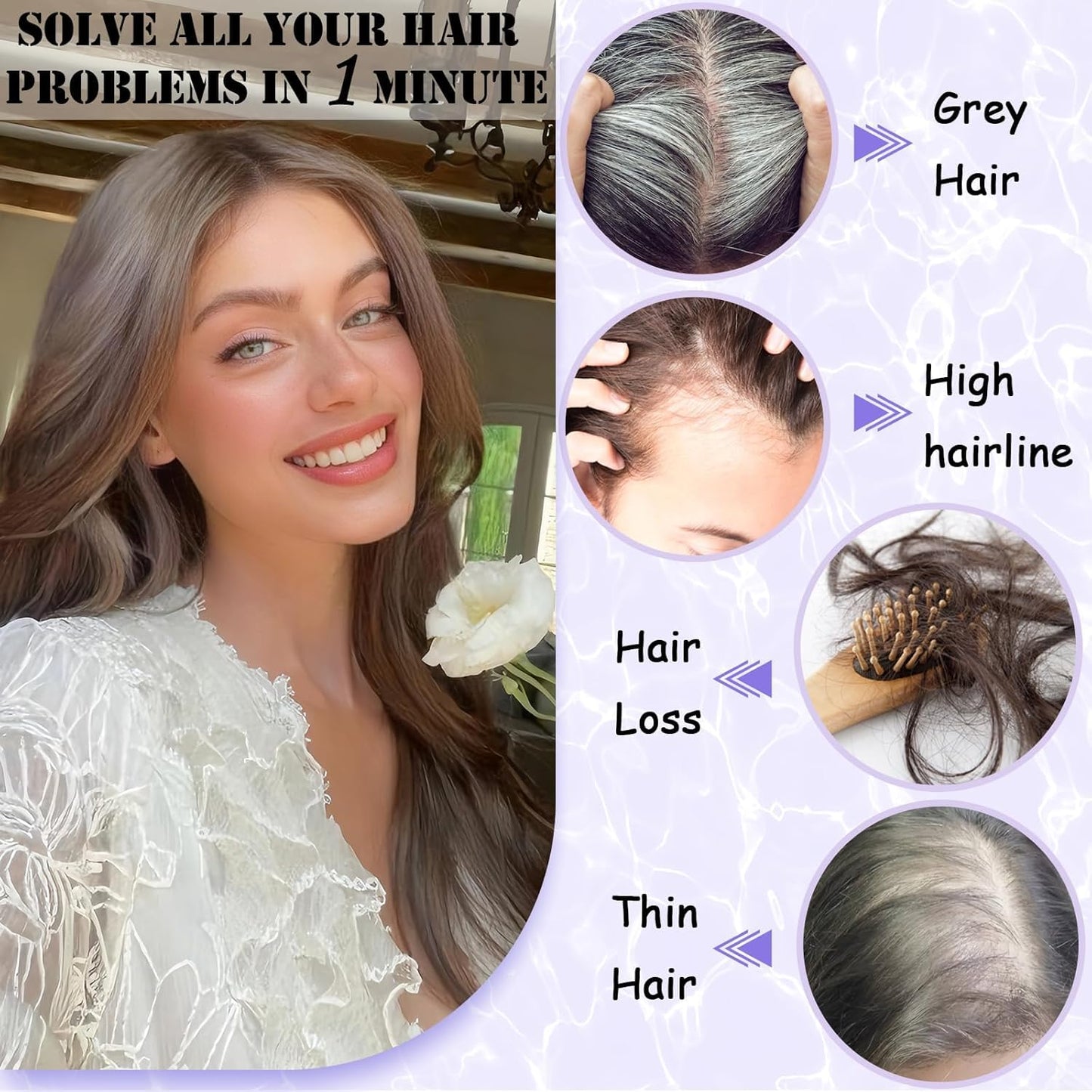 LEDIZE Hair Toppers for Women Real Human Hair, 360° Cover Middle Part Human Hair Toppers for Women with Thinning Realistic Scalp Line Upgrade Basement Toppers Hair Pieces Medium Brown, Side Bangs