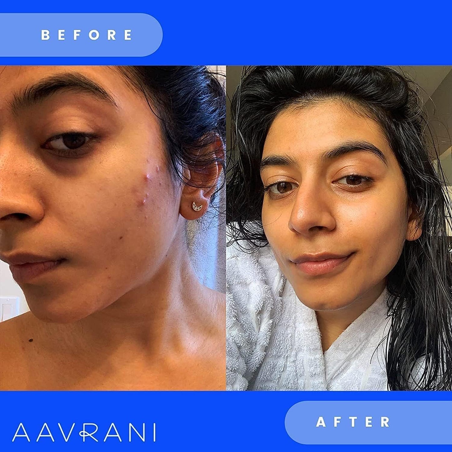 AAVRANI Glow Activating Exfoliator – Stain-Free Turmeric Face Mask with Aloe, JoJoba, Shea, Lavender and Neem – Exfoliating Clay Mask for Acne, Dark Spots, and Deep Pore Cleansing, 1.7 Fl Oz (New)