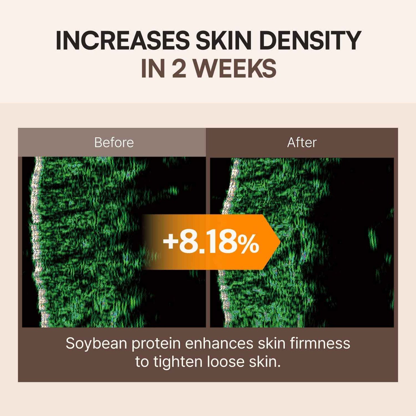 FLASKIN Skin Barrier Essence | Soybean Bouncy Protein Essence | Moisturizing, Strengthens Skin Barrier, Enhances Elasticity | Soybean Protein | Moisturizer for Flaky Skin | Korean Skincare | 80ml