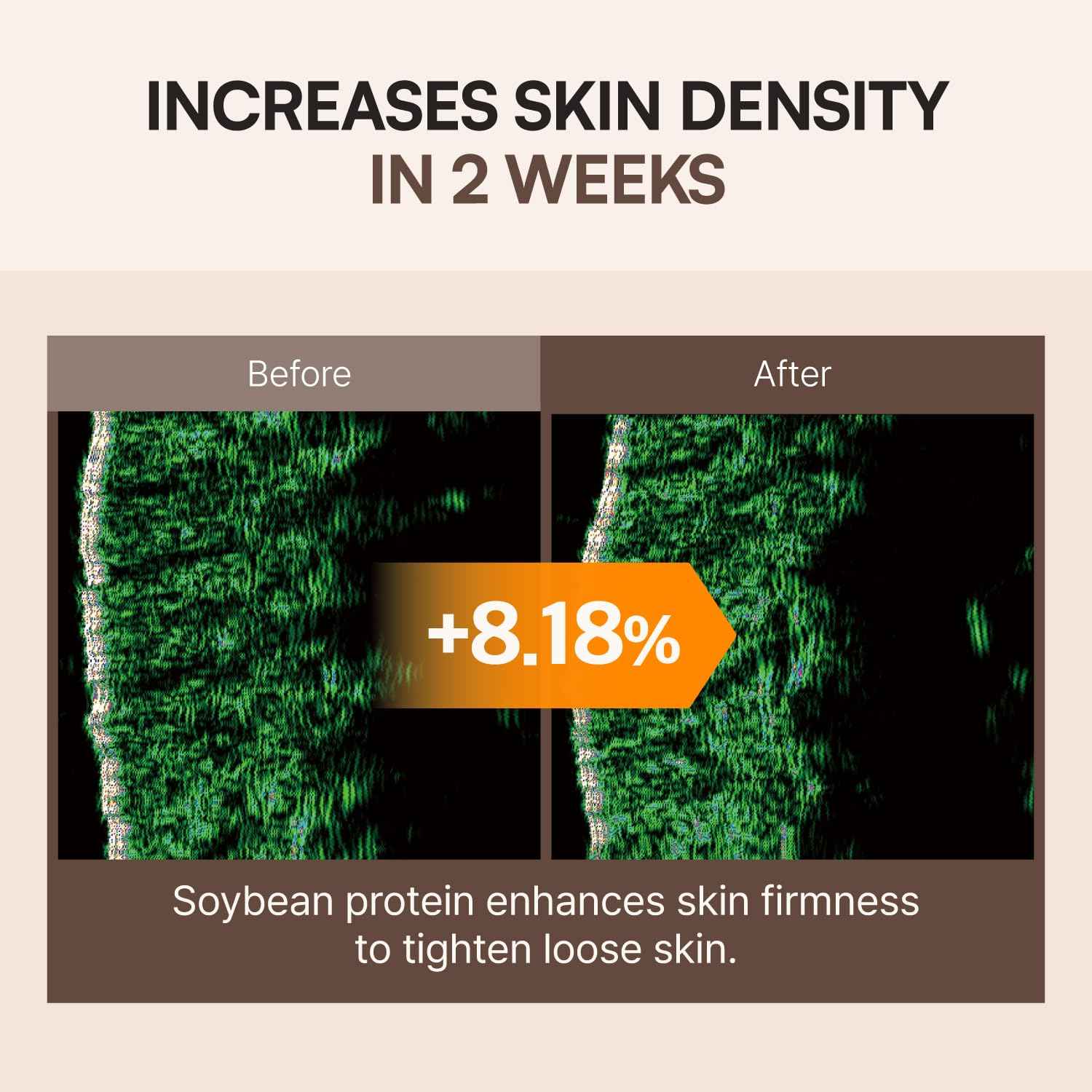 FLASKIN Skin Barrier Essence | Soybean Bouncy Protein Essence | Moisturizing, Strengthens Skin Barrier, Enhances Elasticity | Soybean Protein | Moisturizer for Flaky Skin | Korean Skincare | 80ml