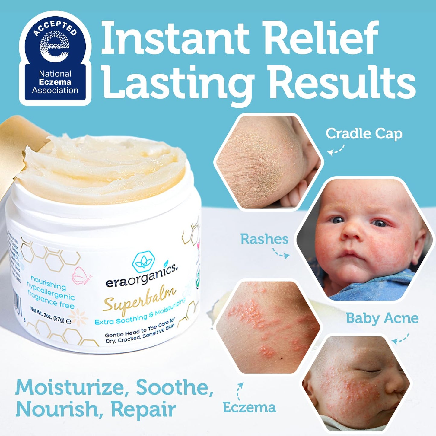 Era Organics Healing Ointment for Babies - Organic Moisturizer for Eczema, Cradle Cap & Rashes | 2oz