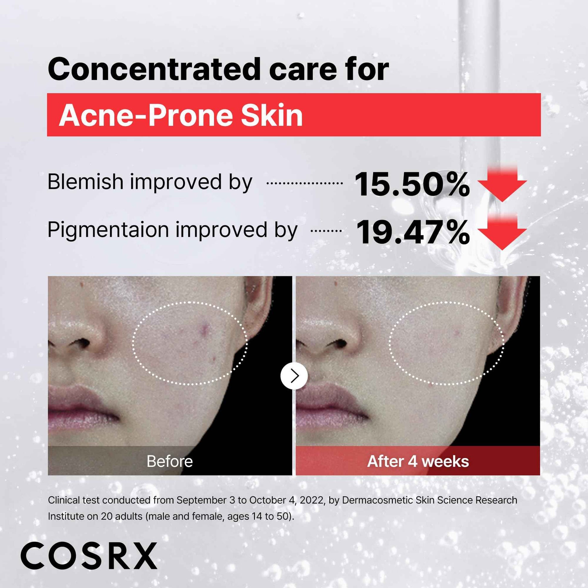 COSRX 15% Niacinamide Face Serum, 0.67 fl oz, Pore Minimizer Serum for Face, Even Skin Tone, Korean Skin Care, Stocking Stuffers, Gifts For Women