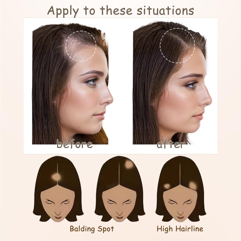 viviaBella human hair hairloss on temples bald spot toupee scar human hair replacement hairline straight Tape-on Triangle hair patch for men and women（2Pcs） (Dark Brown, about 1"*1"*1")