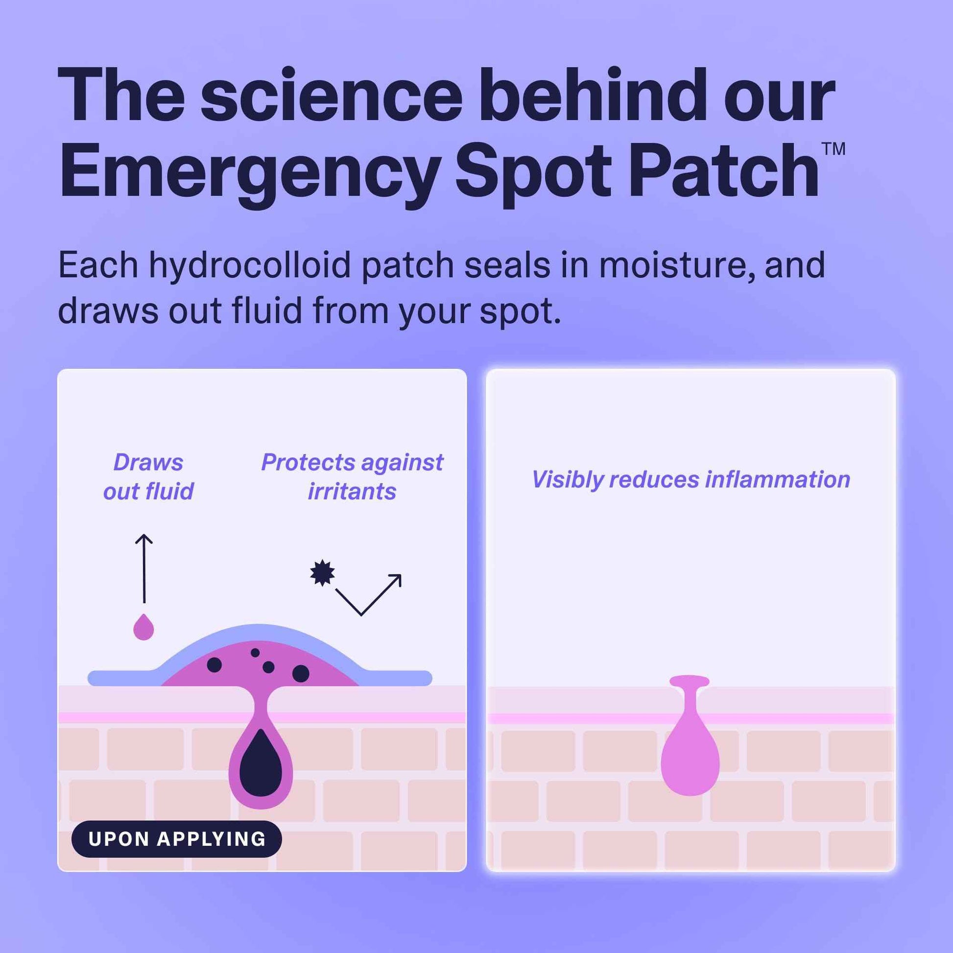 Curology Emergency Spot Pimple Patches for Face, Stocking Stuffer Gifts, Hydrocolloid Pimple Patches Fast-Acting, 80 Count