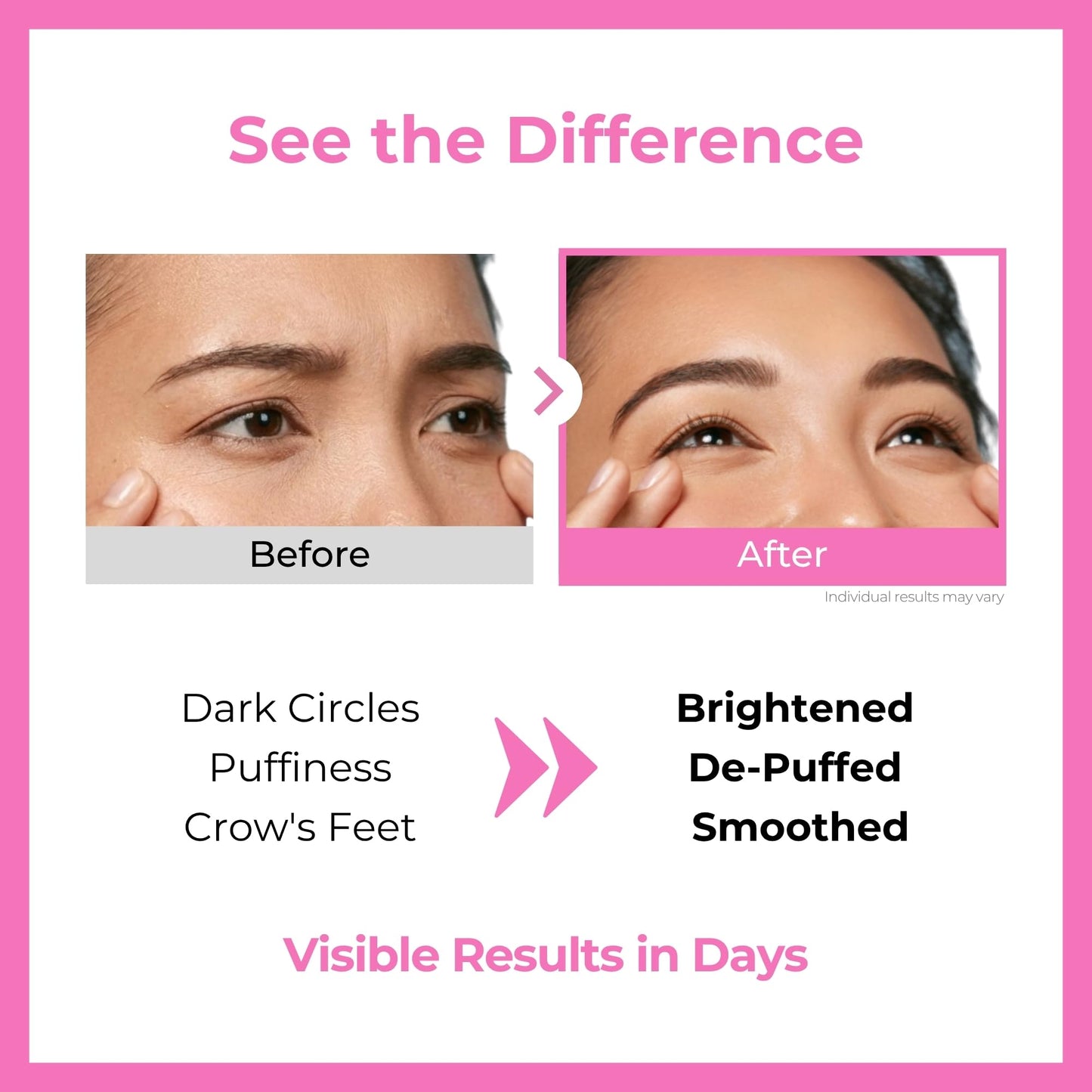 BMBCO Korean Eye Cream | 5 Ceramides + 6x Hyaluronic Acid + Centella | Anti-Aging for Dark Circles, Wrinkles & Puffiness | Firms, Brightens & Deeply Hydrates | For Face & Neck | 1.01 oz