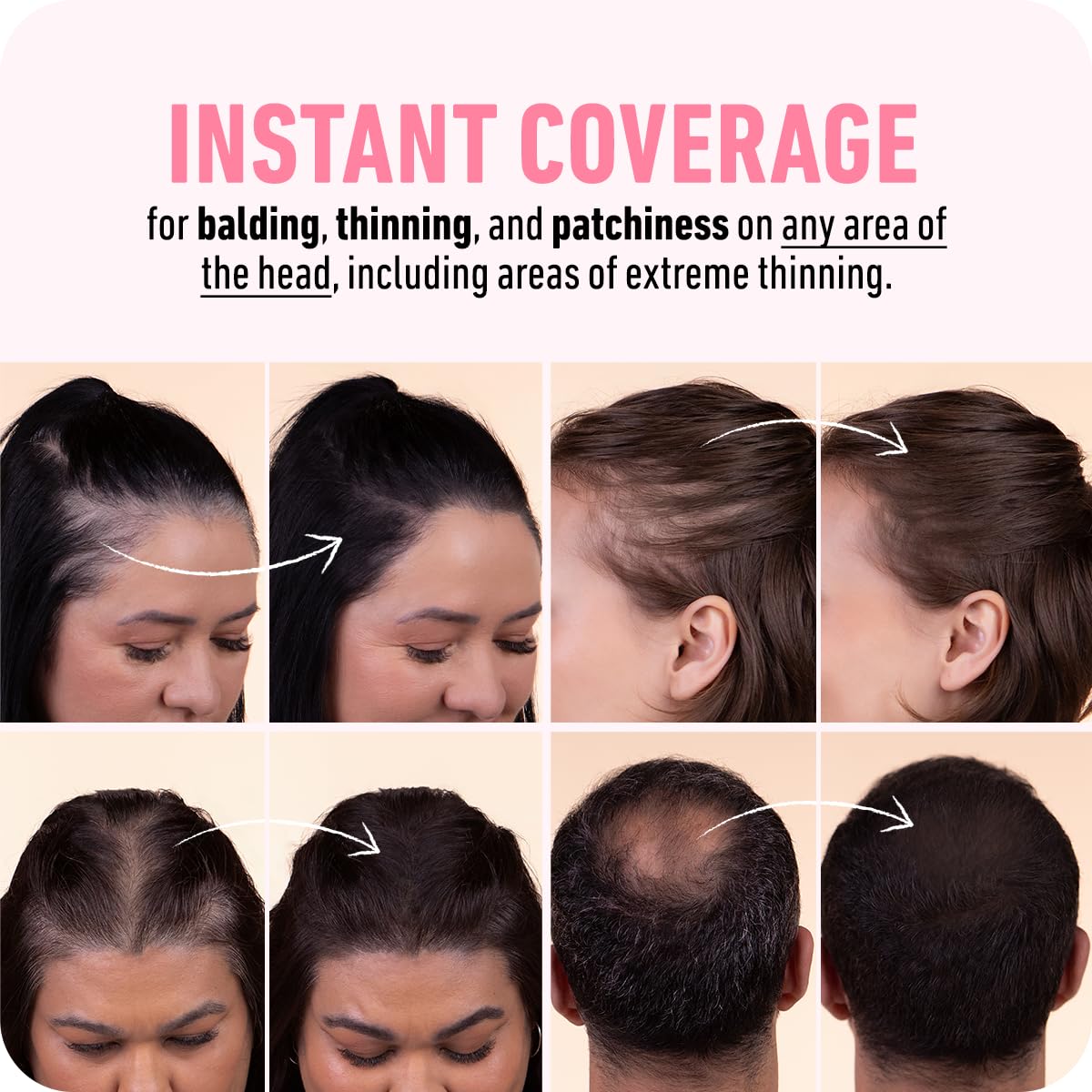 BOLDIFY Hairline Powder - Water-Resistant Root Touch Up Hair Color for Gray Coverage - 24-Hour Stain-Proof, Mess-Free Hair Powder for Thinning Hair - Medium Brown