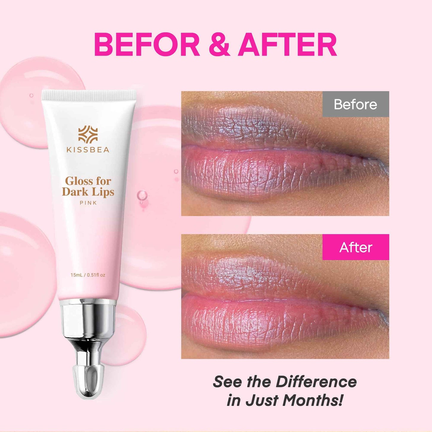 KissBea Lip Lightening for Dark Lips: for Smokers, Dry or Uneven-Toned Lips – Restores Natural Look & Moisture with VC, Lemon Peel & Licorice – Refreshing Mint Scent – 15 mL