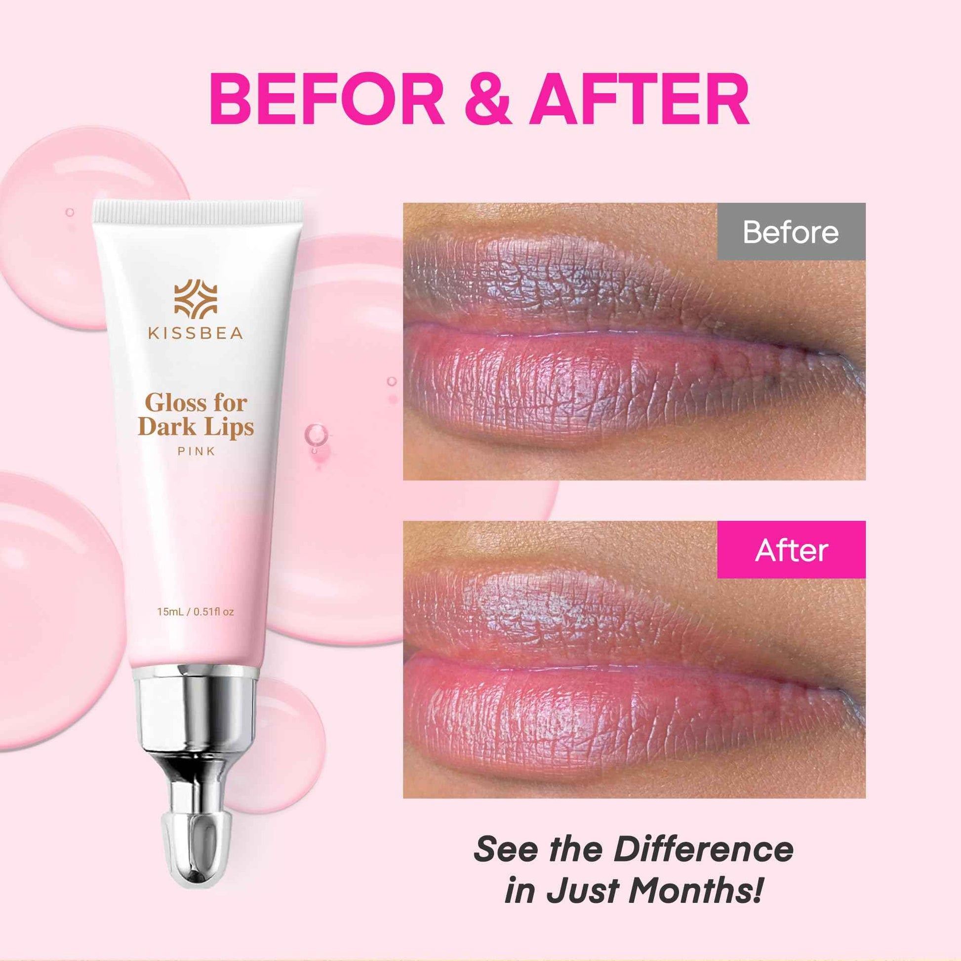 KissBea Lip Lightening for Dark Lips: for Smokers, Dry or Uneven-Toned Lips – Restores Natural Look & Moisture with VC, Lemon Peel & Licorice – Refreshing Mint Scent – 15 mL