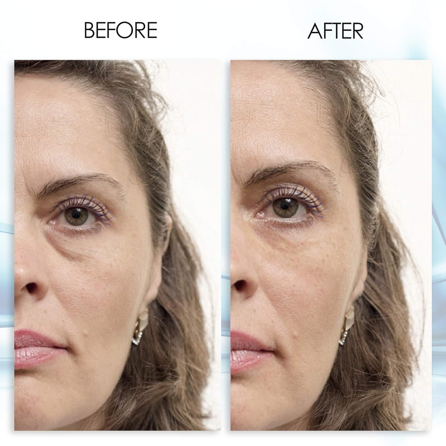 Puffy Eye Gel - Instant Wrinkle Reduction & Puffiness Relief - Hydrating Green Tea Extract | 1 oz