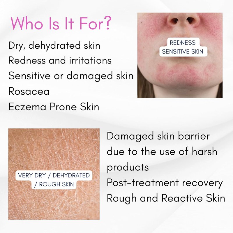 Skin Barrier Repair Serum - Restore & Strengthen Sensitive Skin | Ceramides, EGF, Oat Extract | Fragrance-Free (1 fl oz)