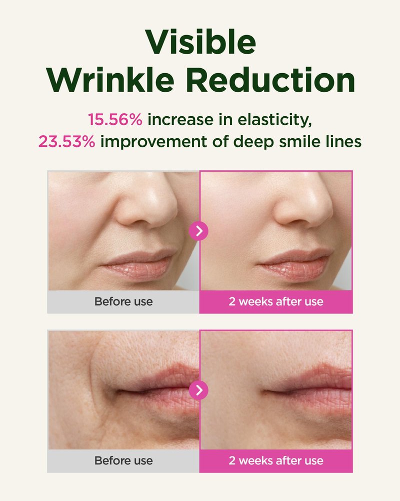 CKD Retino Collagen Guasha Serum with Stainless Steel Roller, Lifting & Firming Face Serum for Wrinkle Care, Collagen Boosting Hydrating Anti-Aging for Radiant Skin, Korean Skincare, 1.35 fl oz