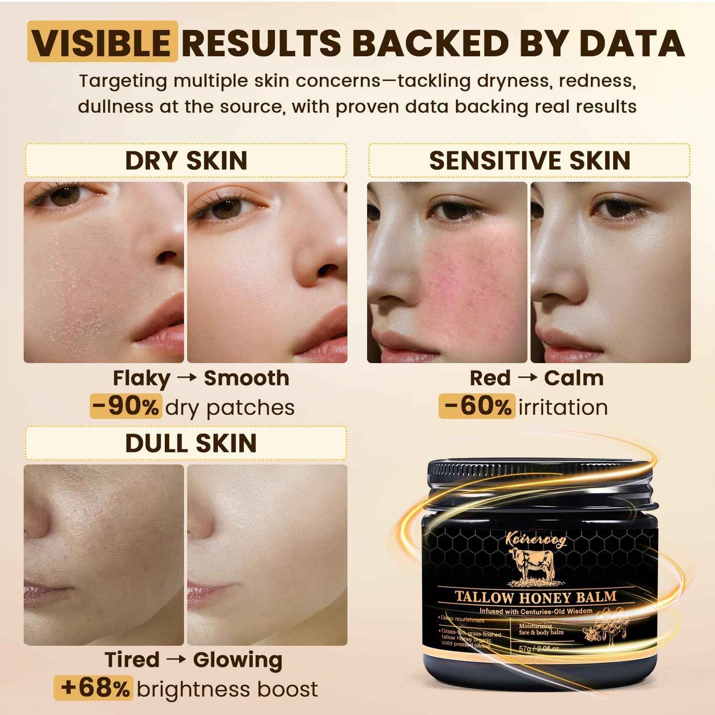 Koirerooy Beef Tallow for Skin, Organic Grass-Fed Beef Tallow and Honey Balm for Face, Natural Formula for Dry Skin (unscented) (2.0Fl Oz, Unscented)