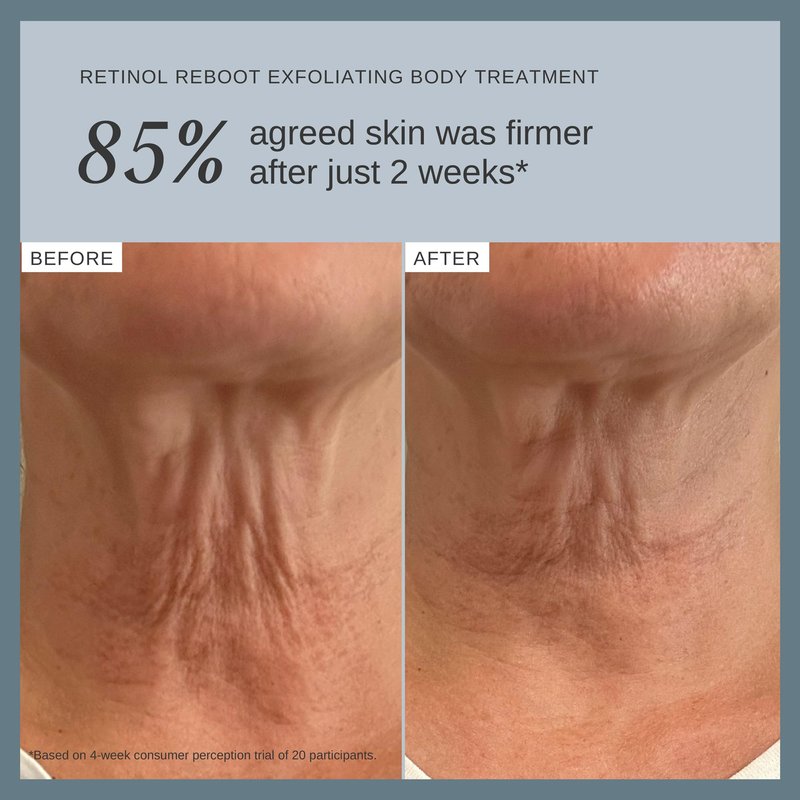 Alpha-H Retinol Reboot Exfoliating Body Treatment 120ml - Firm, Smooth & Brighten Body Skin - Reduces the Appearance of Fine Lines, Redness & Uneven Tone - Neck, Décolletage, Arms & Legs
