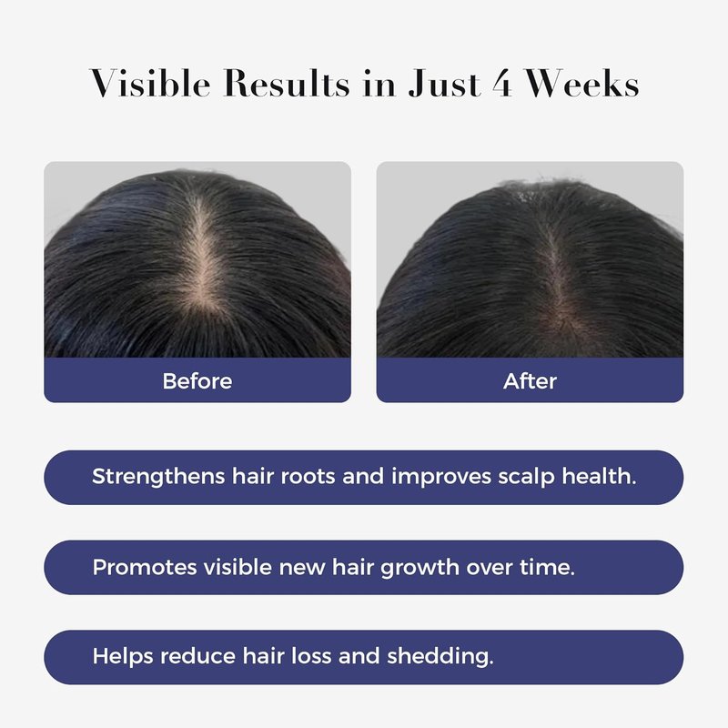 Hair Growth Serum Roll-On - 3% Rosemary & 6% Batana Oil | Fast-Absorbing Solution for Thinning Hair (2 Pcs)