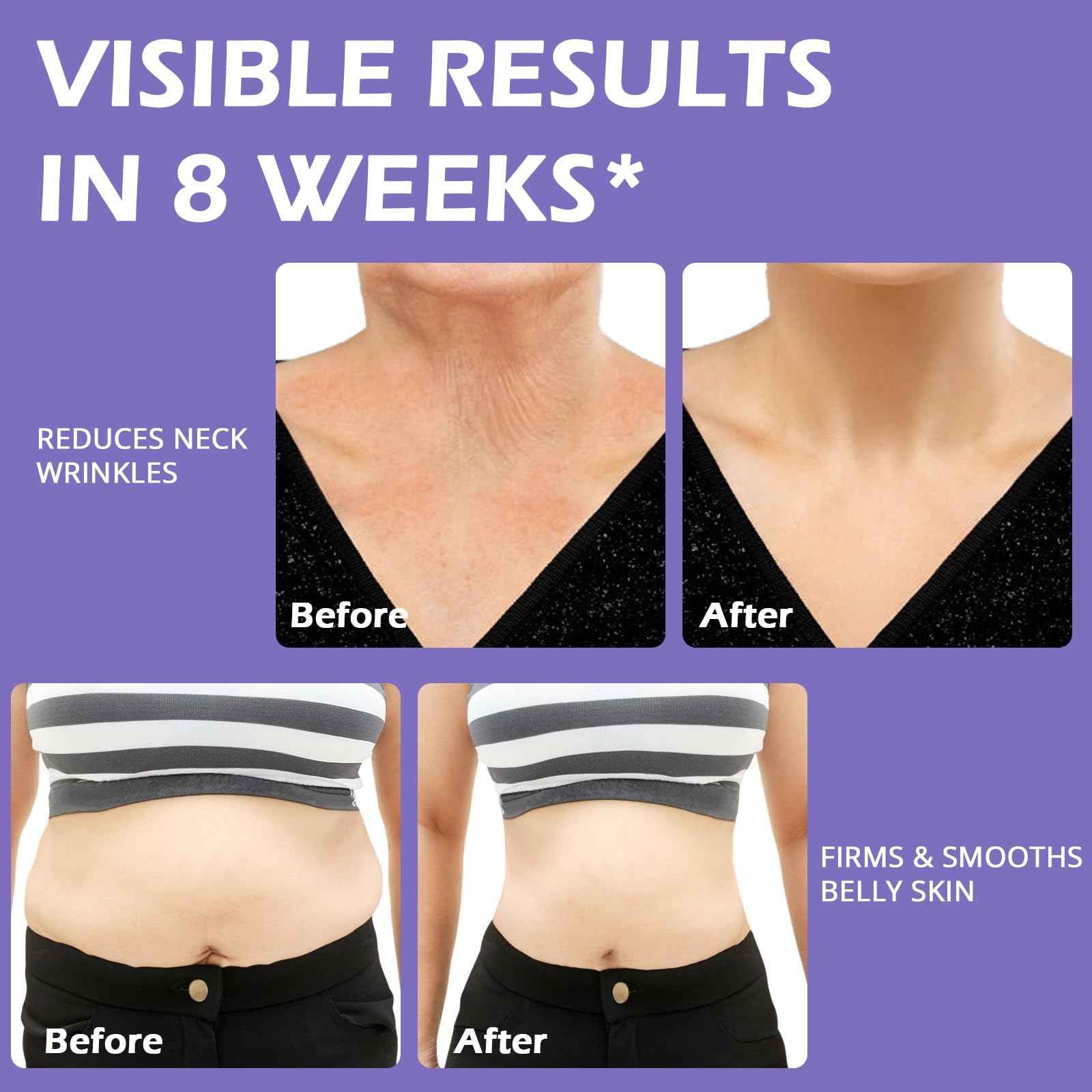 ZL7QHSE Get Dreamy Overnight Toning Whip,Lightweight Firming Cream,For Women Seeking Smooth, Tightened Skin,Ideal for Legs, Thighs, Belly & Nighttime Use-1 Pack