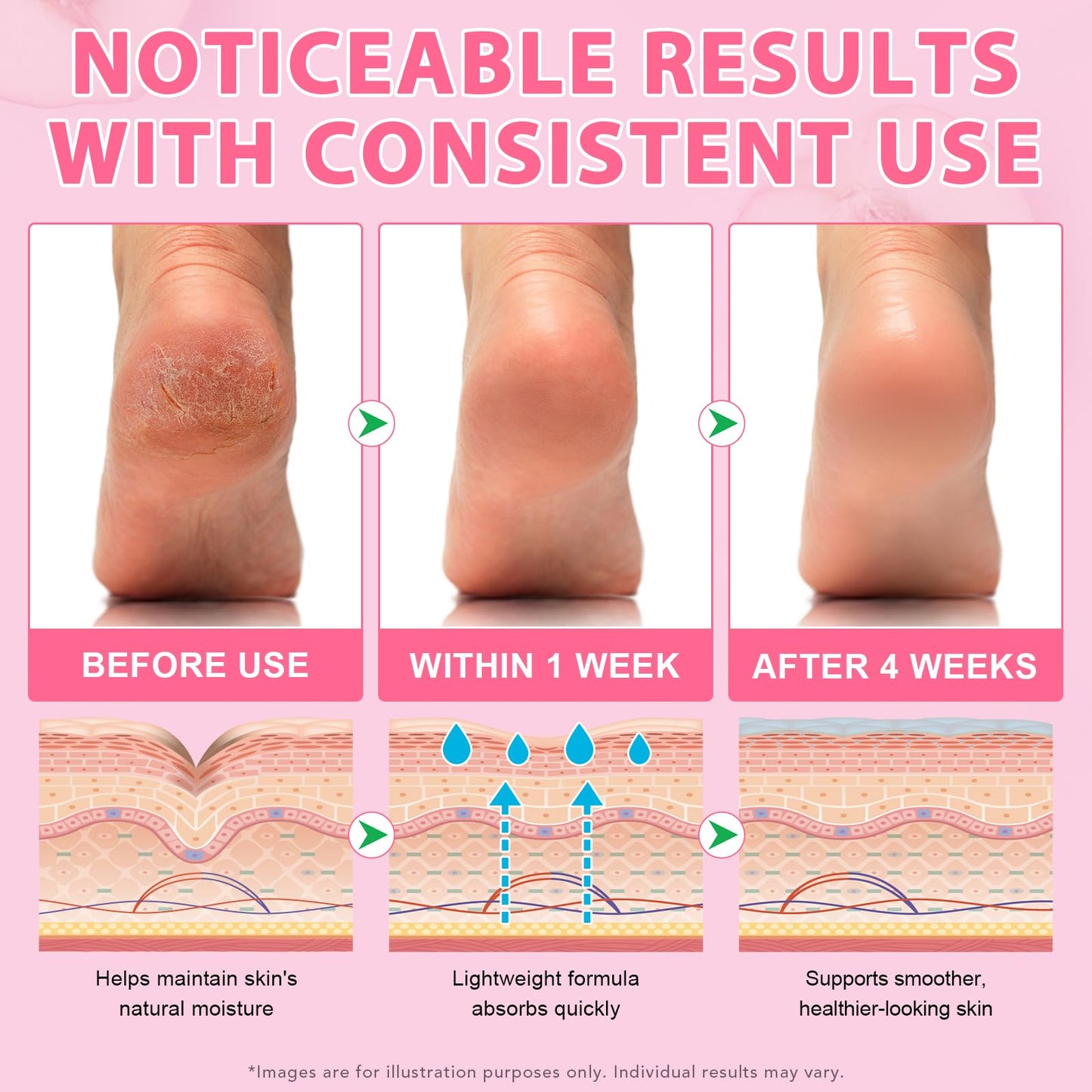 Urea Cream 60% Plus Salicylic Acid 2% Intensive Foot Repair Balm Stick for Dry Cracked/Chapped Heel/Hands Intensively Moisturization, Callus Removal/Softening/Soothing-Peach Scent|1.41 Oz/40 G