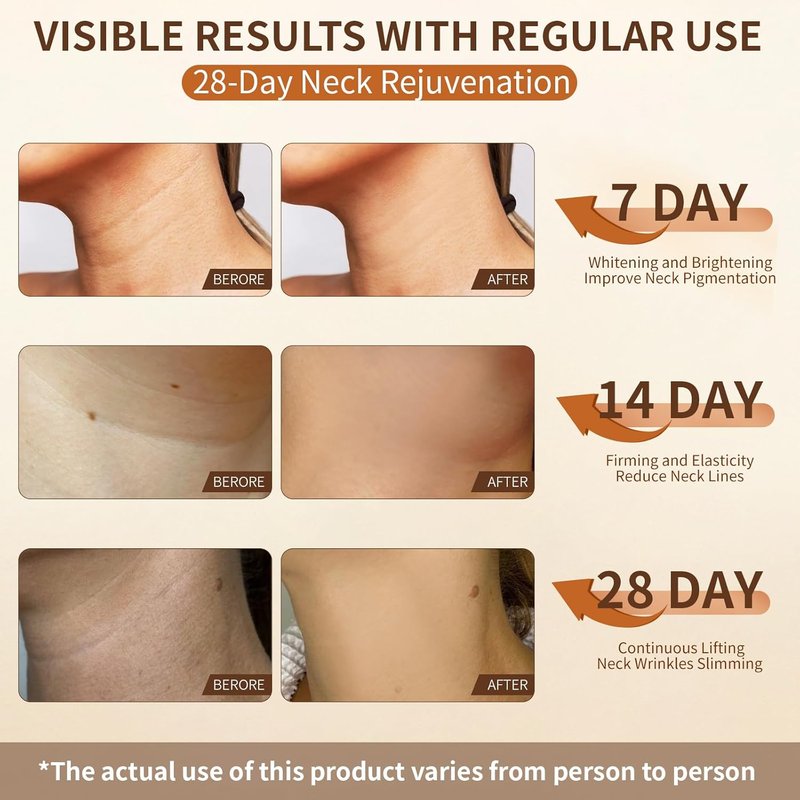Neck Firming Cream - Tighten & Lift for Sagging Skin | Anti-Aging Formula for Youthful Neck