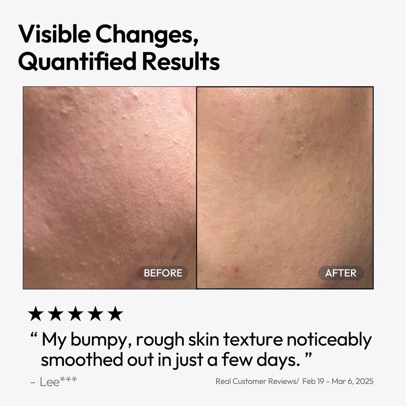 LAYERLAB Triple Retinoid 1.6% Serum | Korean Anti-Aging Serum with HPR, Retinal, Retinol, Niacinamide & 8-Peptides | Visibly Smooths Fine Lines, Firms Skin & Refines Pores | 1.08 fl oz