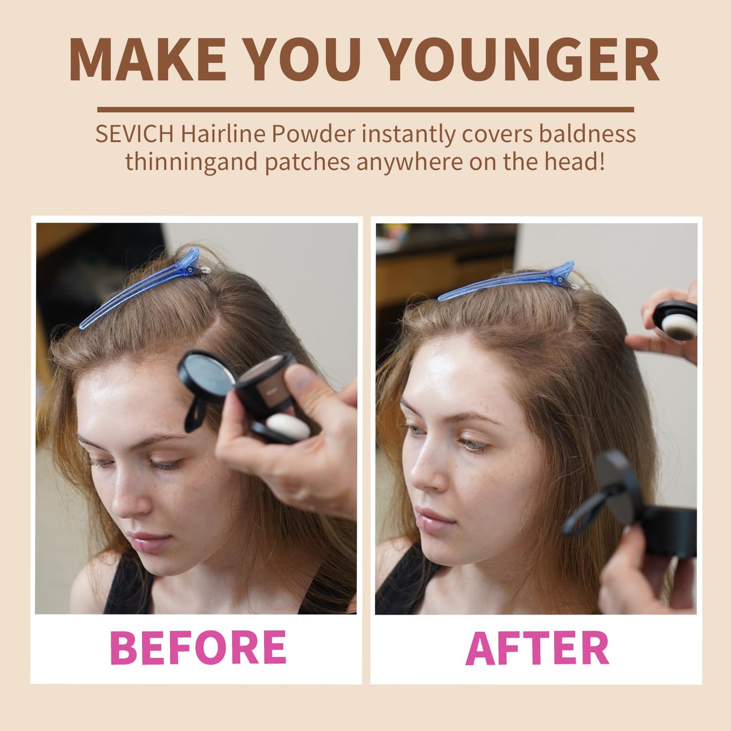 Sevich Hairline Powder,Instantly Conceals Hair Loss, Root Touch up Powder, Hair Shadow Toppers for Women & Men, Touch Up for Thinning Gray Hair, Windproof & Sweatproof,Black