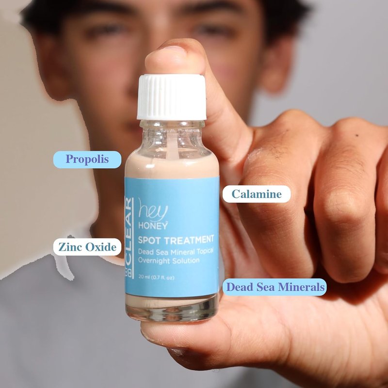 Be Clear Acne Spot Treatment - Overnight Pimple Drying Lotion for Zits & Blemishes | 1 OZ