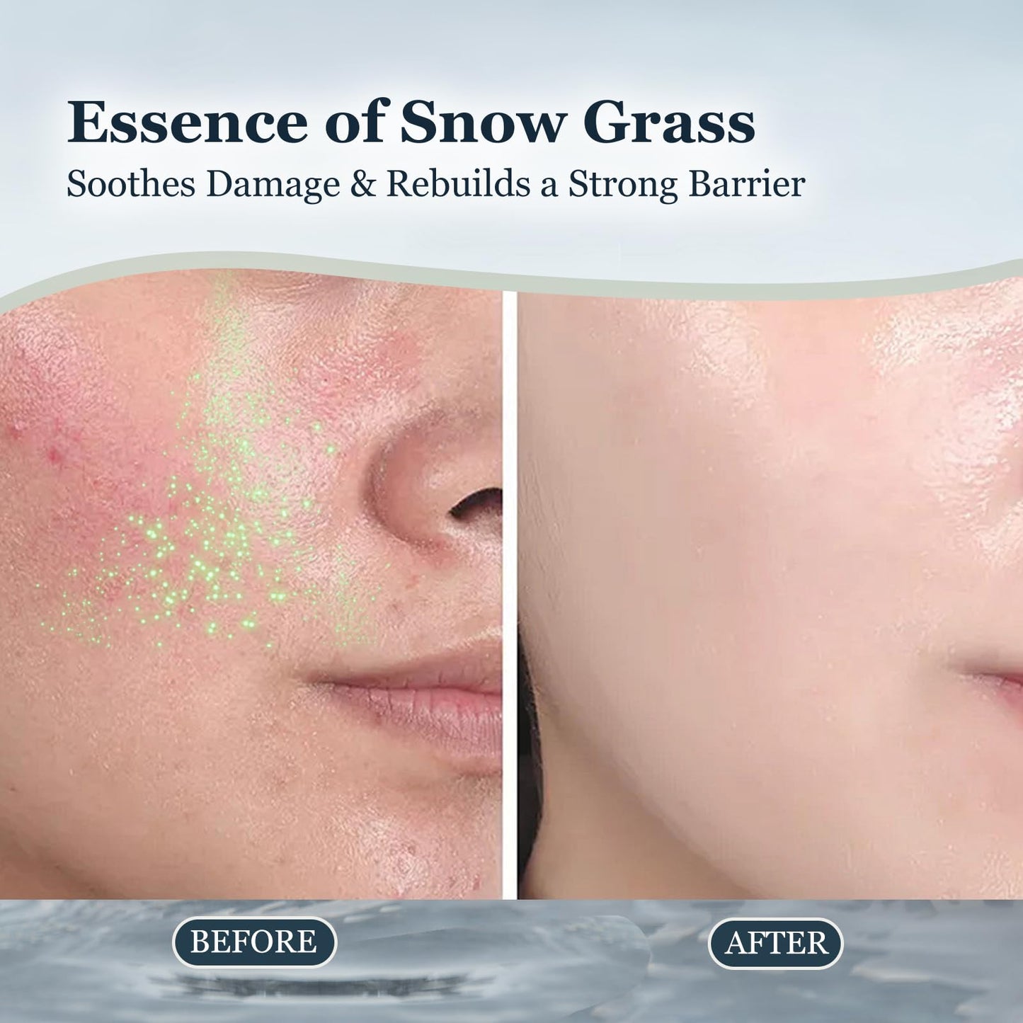 MOAGERDTD CaviarEssence Face Mask - Soothe & Replenish with Centella, Chamomile & Hyaluronic Acid. Calms Redness & Strengthens Skin Barrier for All Types (3.4 oz)