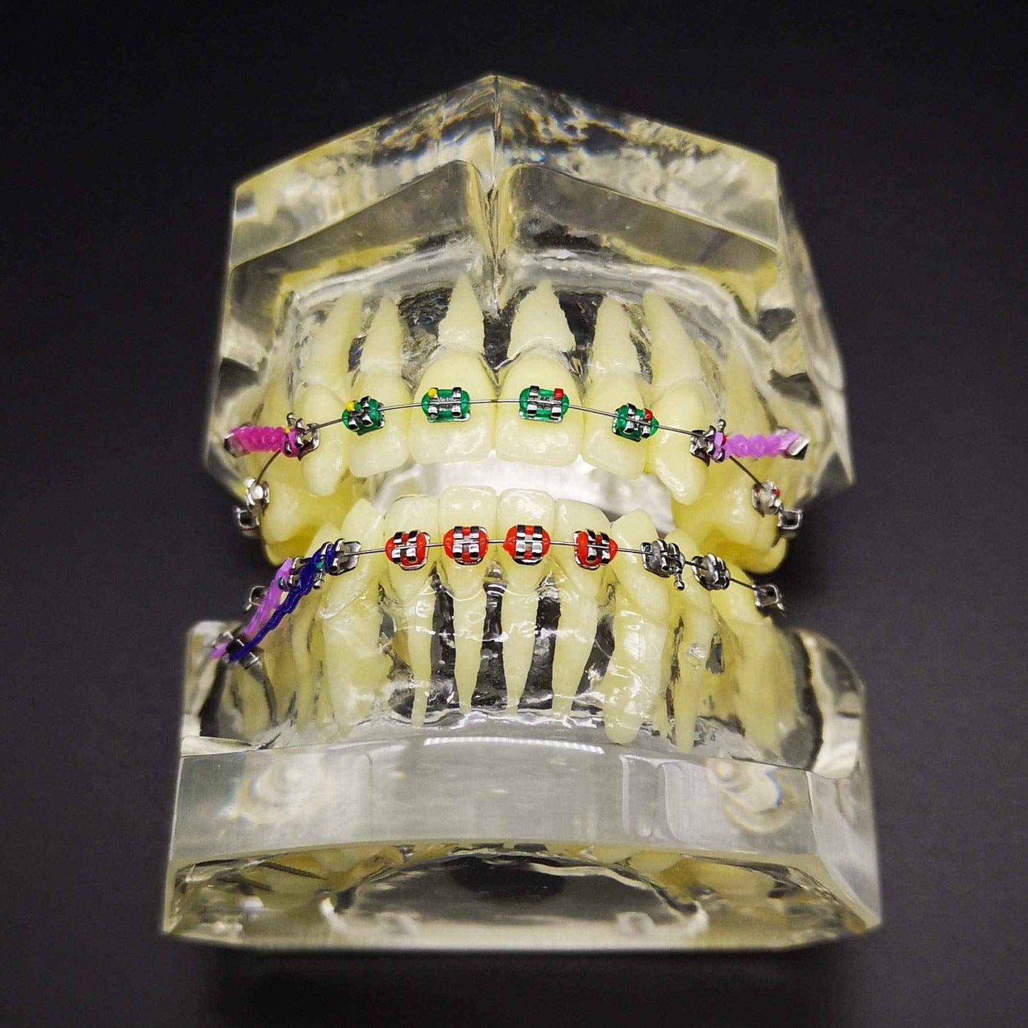 Dental Typodont with Metal Brackets Orthodontic Teeth Model with Ligature Tie