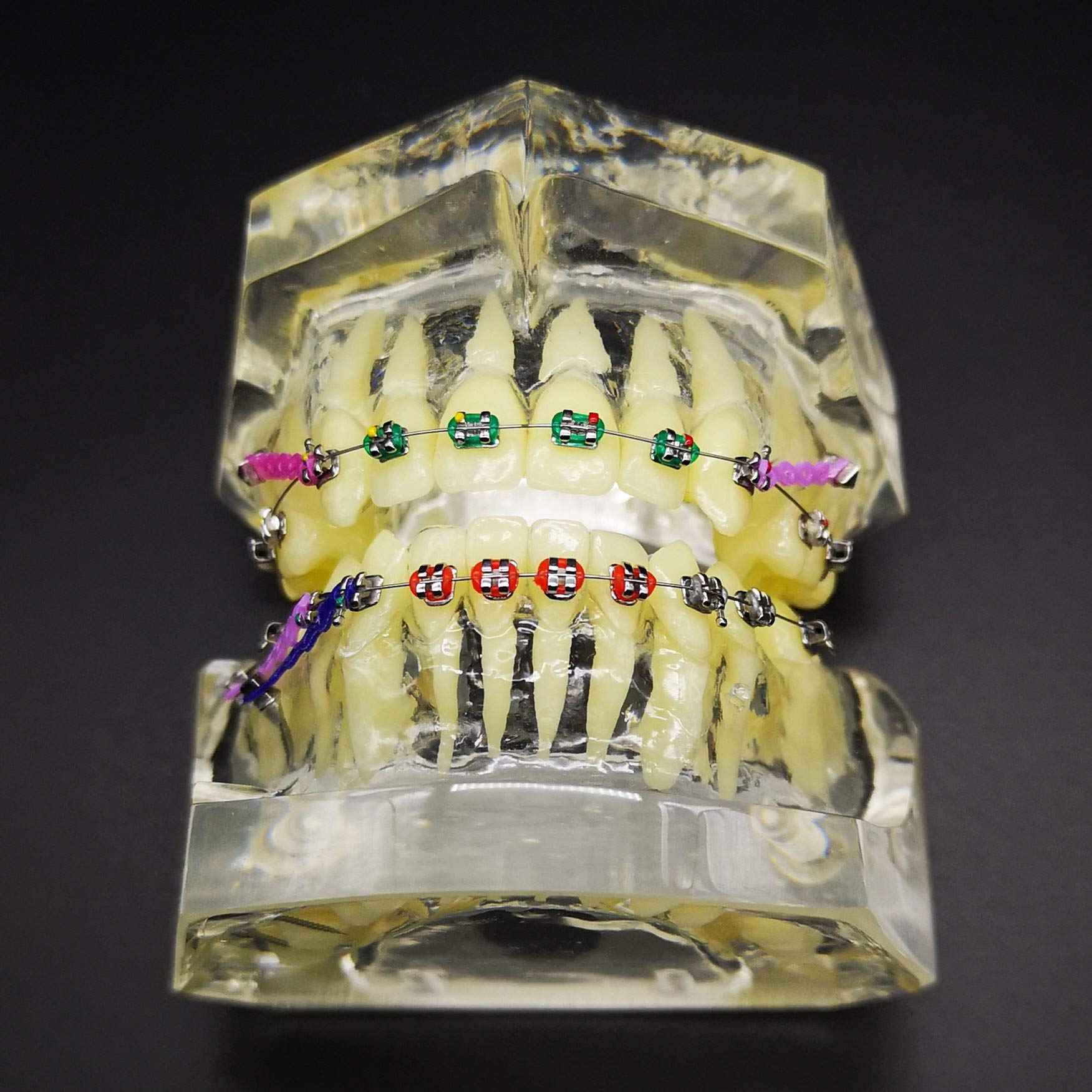 Dental Typodont with Metal Brackets Orthodontic Teeth Model with Ligature Tie