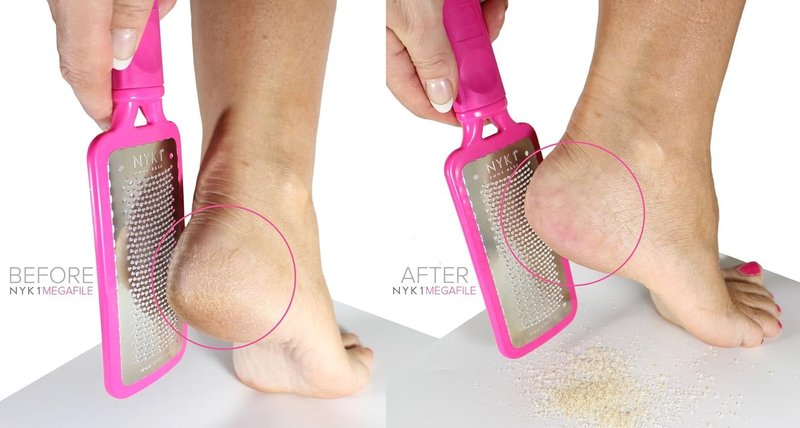 NYK1 Foot File - Original MEGAFILE Pedicure Rasp for Calloused Skin Removal | Extra Large Micro Files