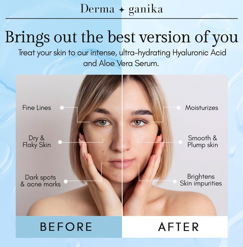 Hyaluronic Acid Serum for Face & Neck - Ultra-Hydrating Anti-Aging Formula with Aloe Vera | Softens & Brightens Dry Skin (Pack of 2)