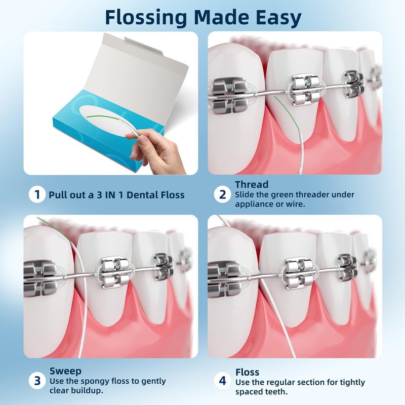 VINSULLA Dental Floss for Braces, Bridges & Implants, 3-in-1 Floss Threader, Spongy & Regular Floss, PFAS & PTFE-Free, 160 Pre-Cut Strands (2 Pack)