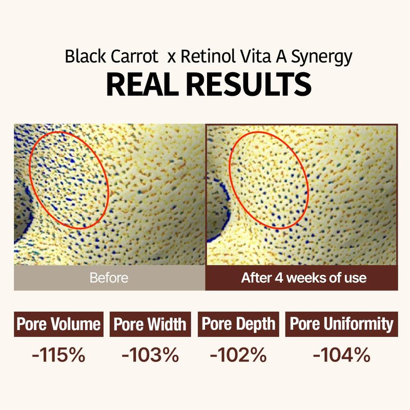 Goodal Black Carrot VITA-A Retinol Ampoule | Hydrating Facial Serum for Glowing Skin - 30ml, Lightweight Korean Skincare