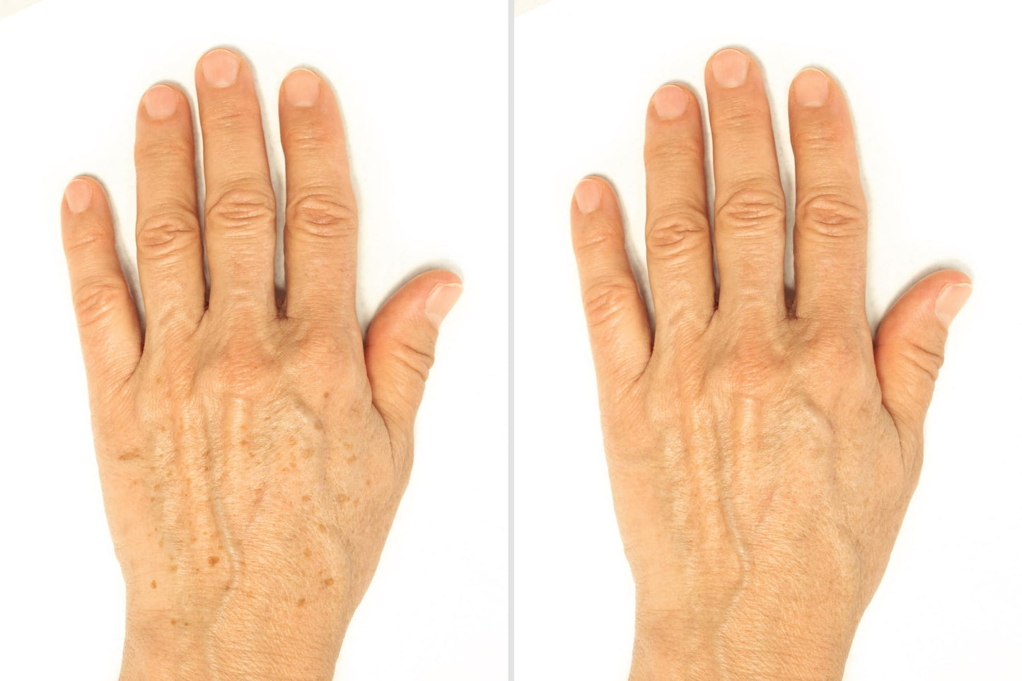 Vitality Precision Skin Micro-Exfoliating Scrub