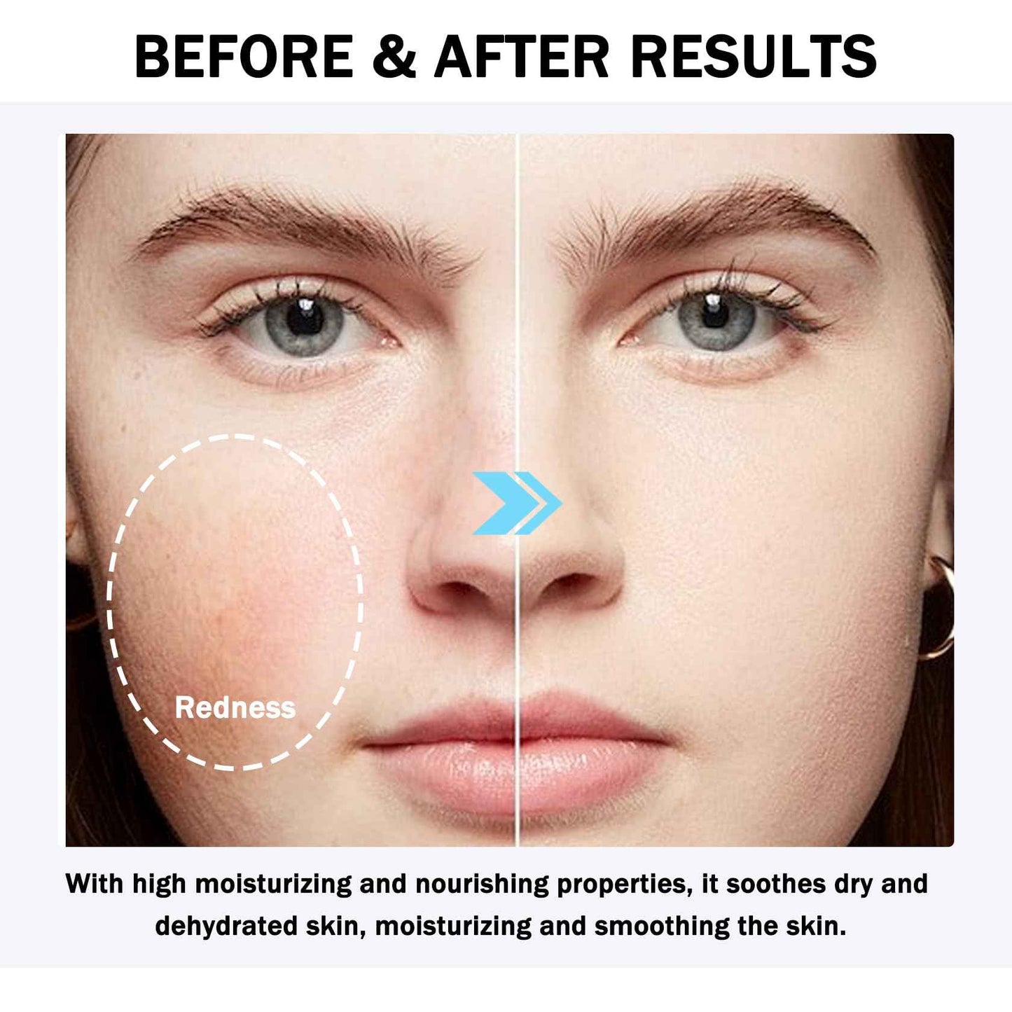 WENJLYJ 16PCS Travel Size Aloe Vera Gel,Soothing After Sun Lotion for Face and Body,Organic Hydrating Aloe Vera Gel for After Sun Care,Instant Cooling,Refreshing Face Moisturizer Set, 1.05 Oz