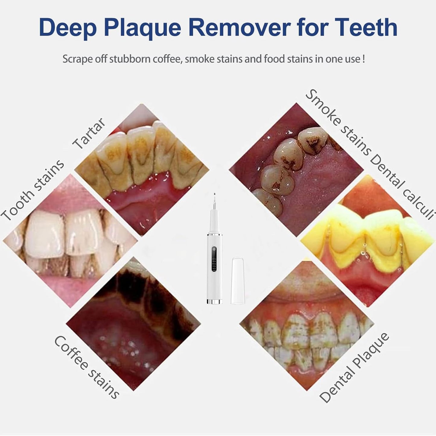 Professional Plaque Remover - Intelligent Teeth Cleaning Tool with 5 Modes & 4 Replaceable Heads | Dental Care Kit