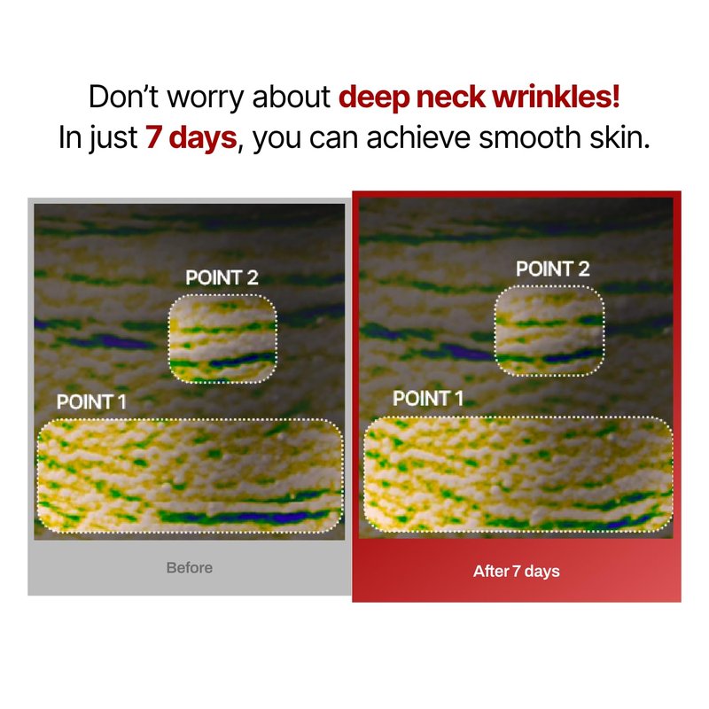 Neck Wrinkle Patches - Firming Korean Collagen Masks for Lifting Sagging Skin | 7 Pack