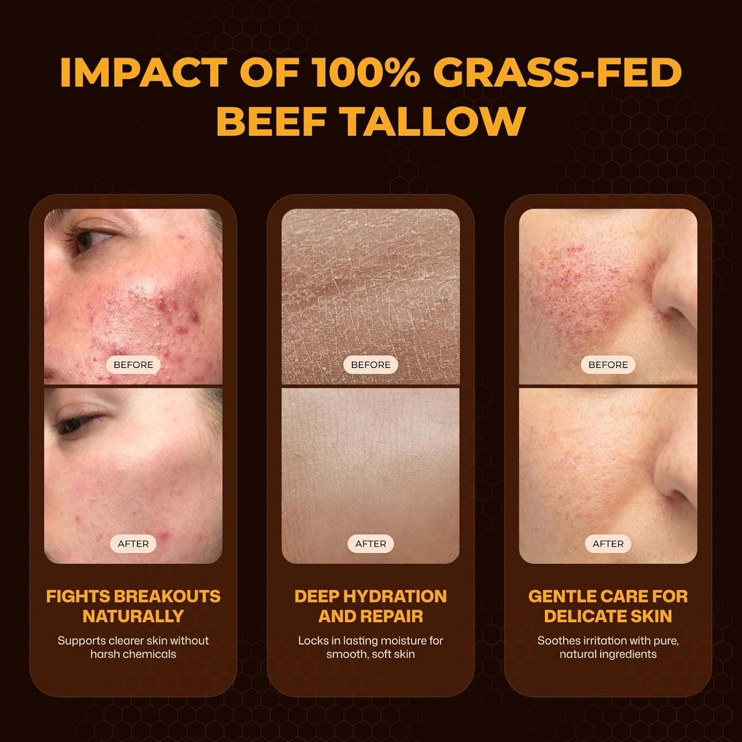 Tallow and Honey Balm for Face - 100% Organic Grass-Fed Beef Tallow & Raw Wild Honey | Moisturizer for Dry & Sensitive Skin (Unscented)