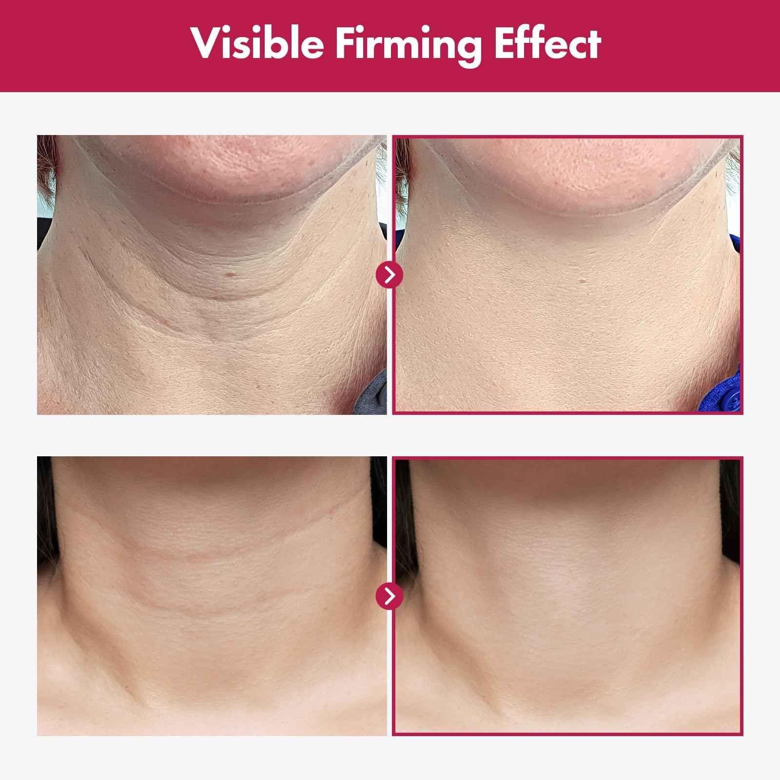 TOSOWOONG Collagen Necktox Cream with Collagen and Hyaluronic Acid for Neck Firming, Anti-aging, Wrinkles and Tightening, Korean Skin Care, 50ml, 1.69 fl. oz.