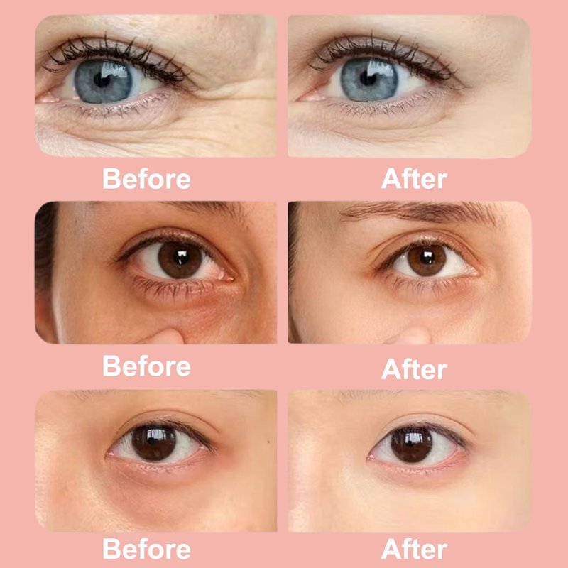 Elitzia Under Eye Red Light Therapy Beauty Device 4 Modes Red Light Therapy Glasses for Eyes Bags, Dark Circles, Puffiness, Wrinkles Fine Lines, Soothing and Refreshing for Women & Men ET110N