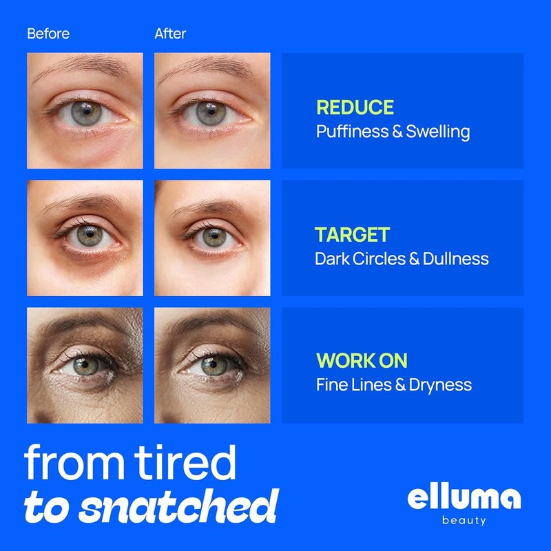 Hydrogel Under Eye Patches - 12 Pairs for Puffy Eyes, Dark Circles & Wrinkles | Chamomile Infused