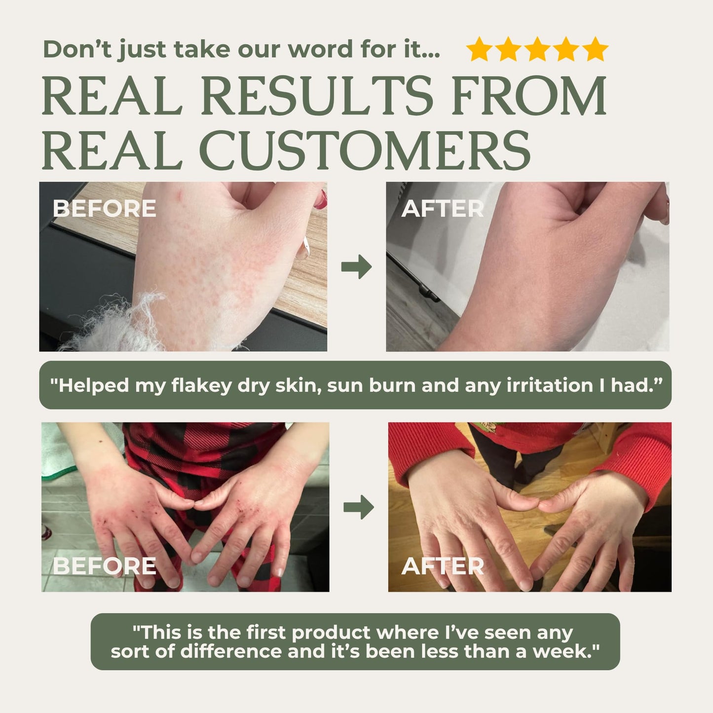 Hearth & Homestead Whipped Beef Tallow for Skin & Face - 100% Grass Fed, Eczema Cream & Body Butter - Organic Olive Oil, Calendula & Rose - Lotion & Hand Moisturizer for Dry Skin, Unscented, 1.3oz