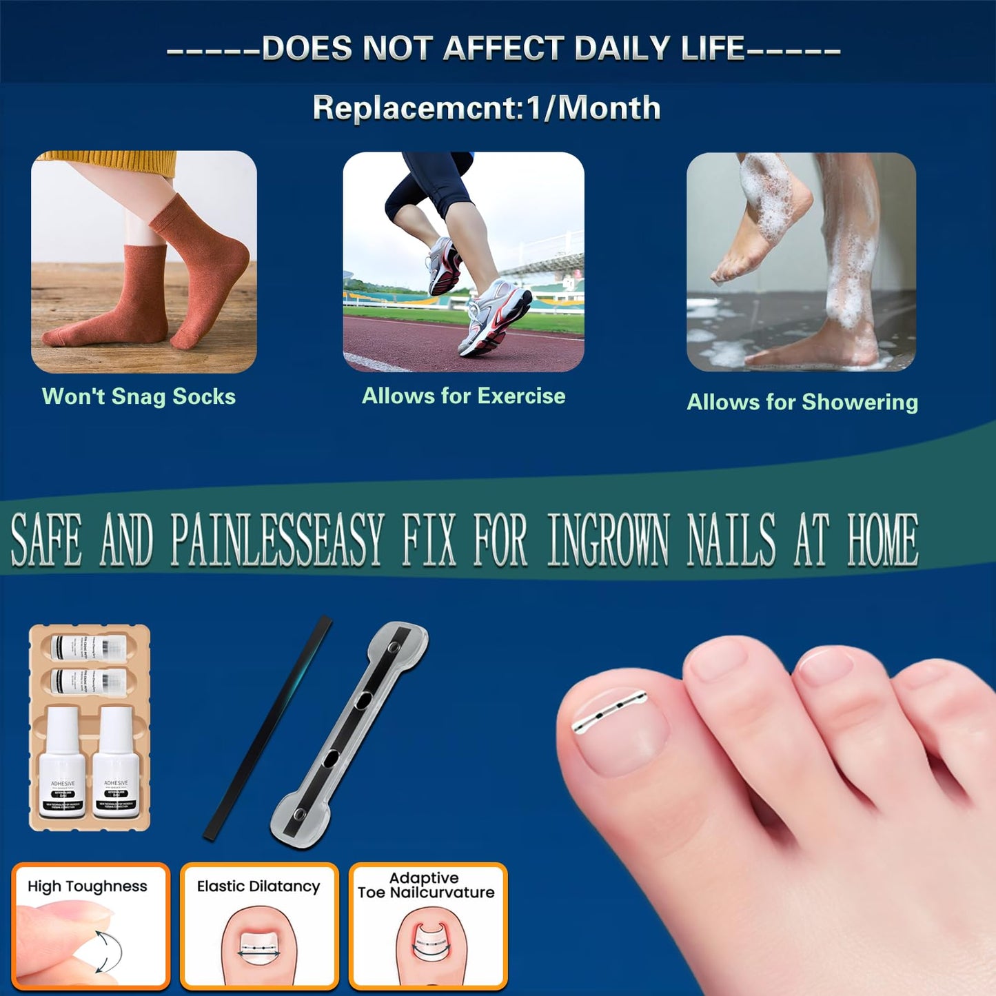 Titanium Alloy Ingrown Toenail Treatment for Curly Ingrown Toenail Corrector - Home Use arc Ingrown Toenail Removal Kit,Men, Women and Curled Toenail Corrector