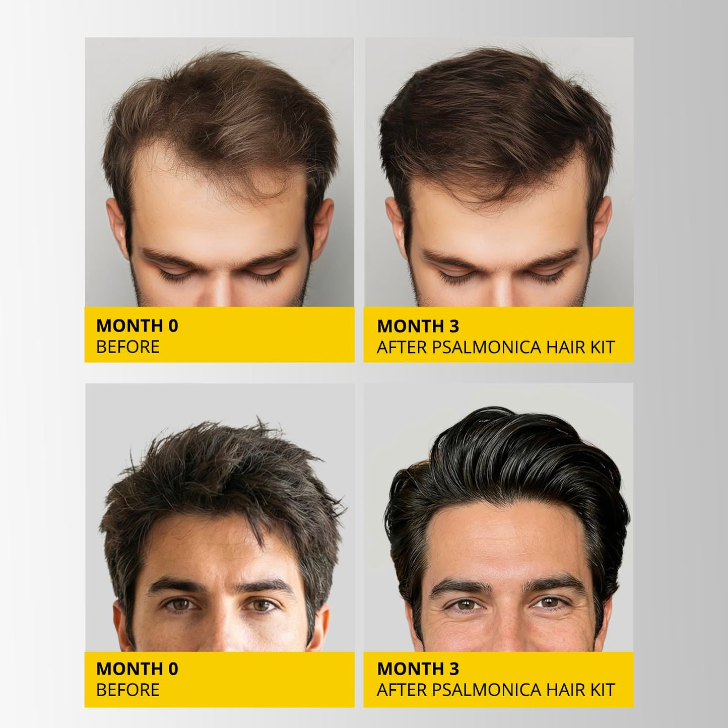 Hair Growth Shampoo and Conditioner Set - Sulfate-Free Thickening Formula for Hair Loss | Regrowth Treatment for Men & Women