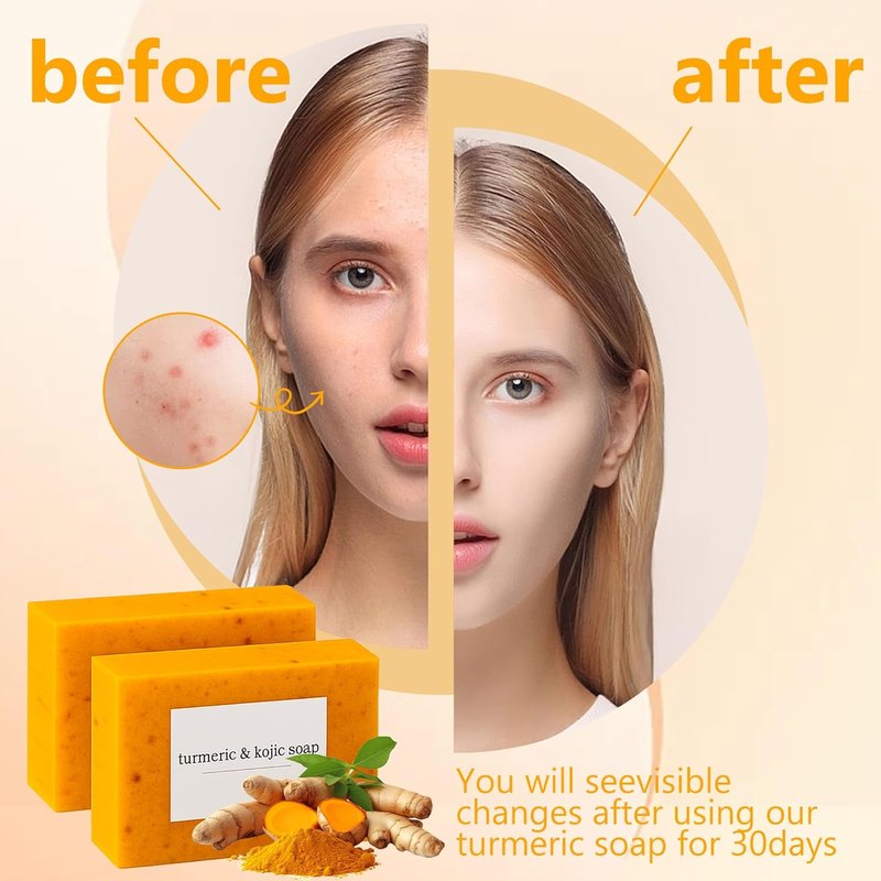 Lemon Soap with Vitamin C & Collagen | Moisturizing Shea Butter for Face & Body - 4 Bars
