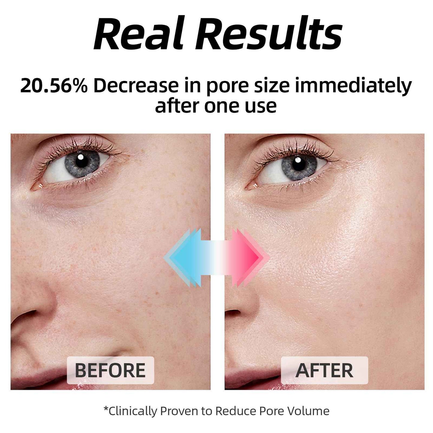 MEDB Hydracalm Toner Pads - 60 Counts Exfoliating Face Pads with BHA & PHA for Acne & Breakouts, 40% Centella Asiatica for Sensitive Skin, Hydrating, Alcohol-Free, Korean Skin Care