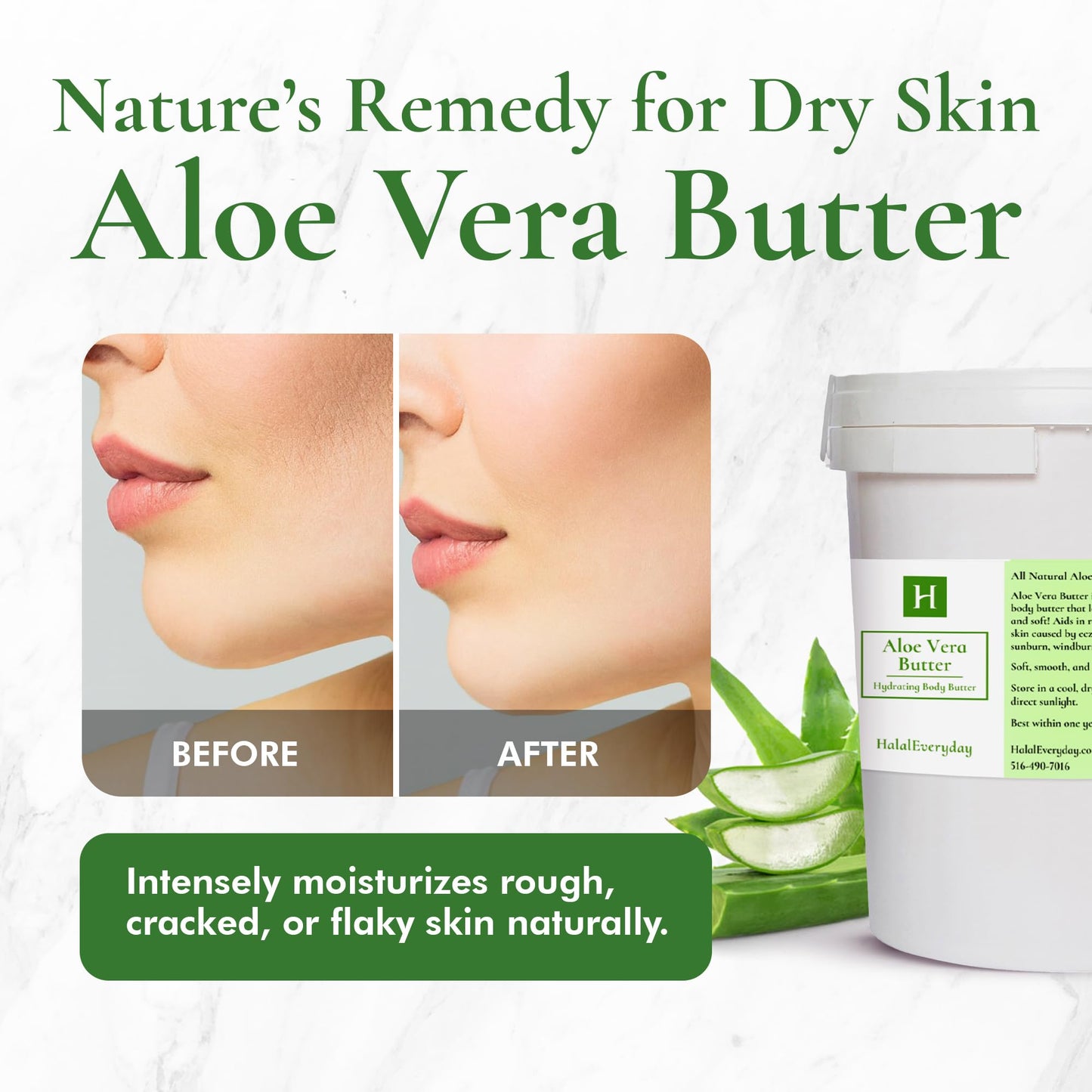 SAAQIN Aloe Vera Butter –Hydration of Dry Skin Caused By Eczema, Psoriasis, Rosacea, Sun Burn, Wind Burn, and General Chapping 16 Oz