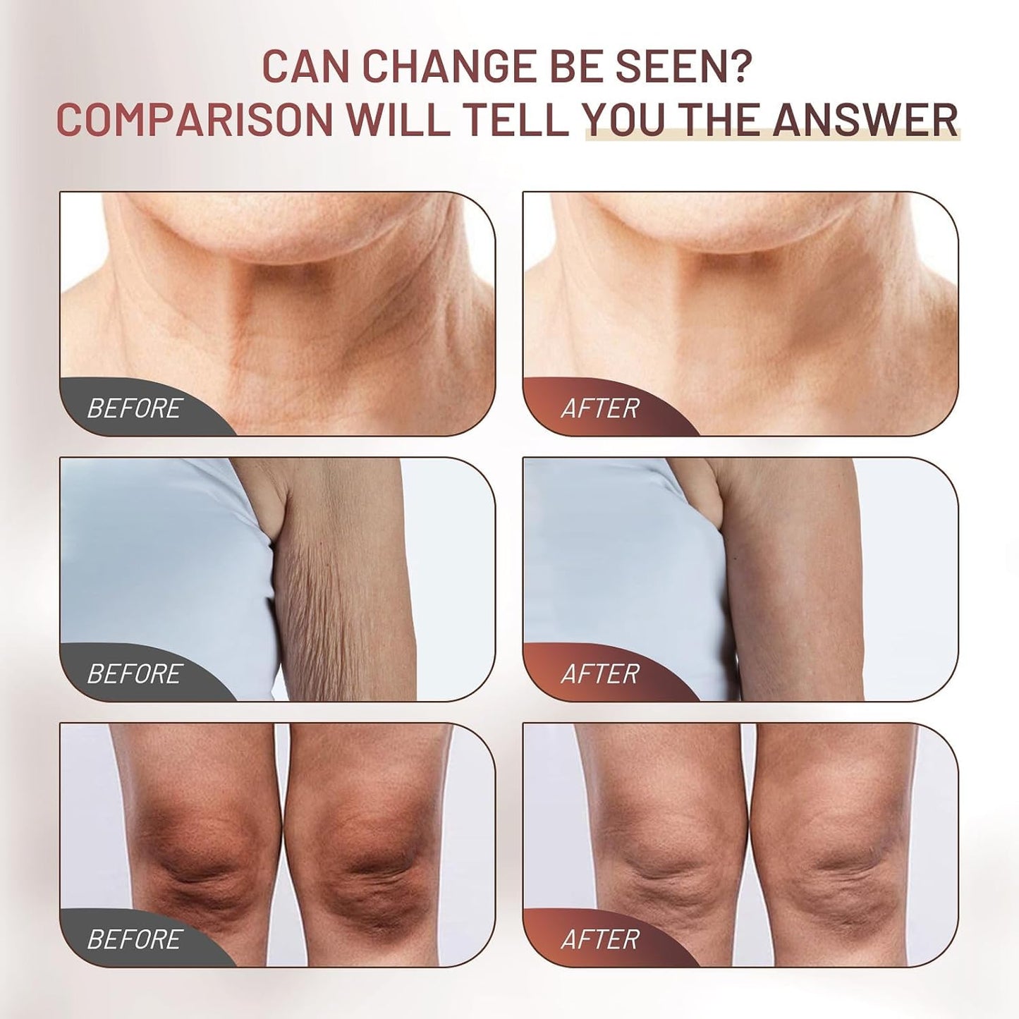 ZZILME Crepe Fix Body Cream, Hydrating & Smoothing Moisturizer for Face, Neck & Body, Helps Improve the Look of Crepey Skin, Lightweight Fast-Absorbing Formula for Women & Men, 4.2 Fl Oz