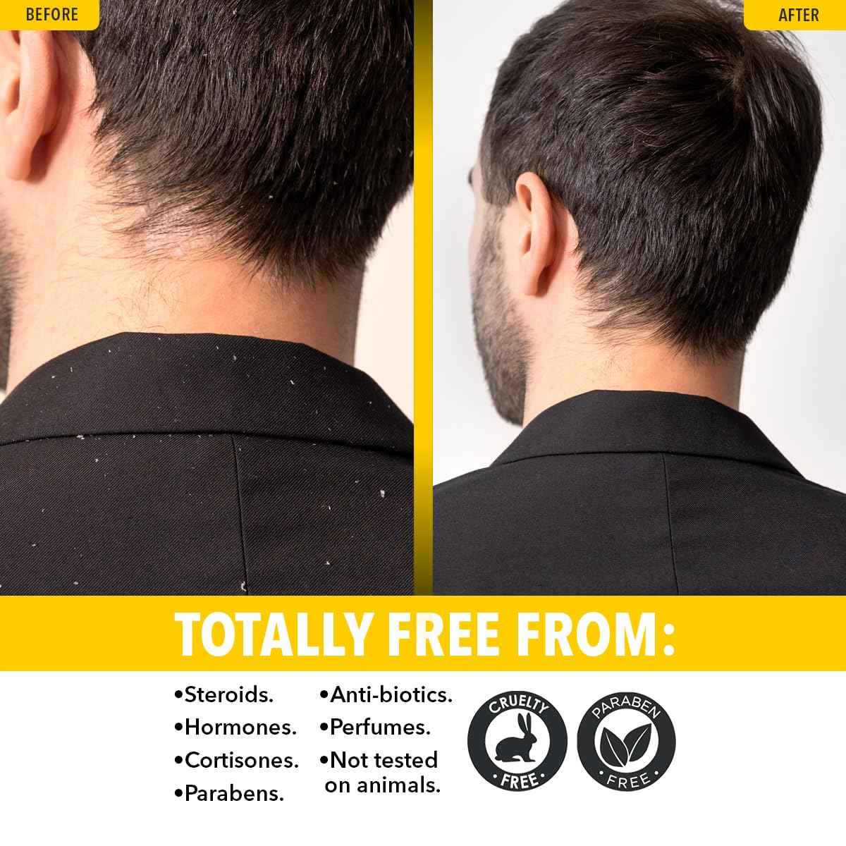 Dr. Robaina Sulfur Shampoo & Body Wash – Helps Soothe Dandruff, Seborrheic Dermatitis, Folliculitis & Itchy Scalp – Color-Safe, SLS-Free, Citrus-Mint Scent, 8 fl oz - Made in the USA