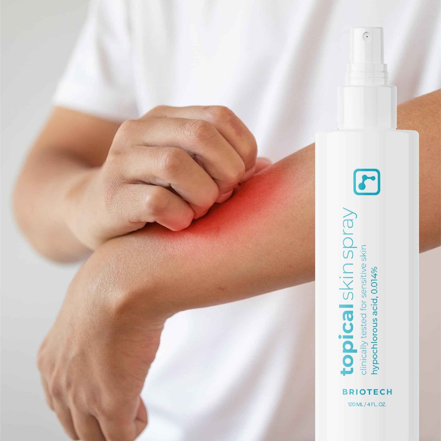 BRIOTECH Topical Skin Spray, Hypochlorous Acid Spray for Sensitive Skin, HOCl Facial Mist, Full Body Support Against Irritation, Calm Redness, Soothe Foot & Scalp, 8 oz (1 Pack)